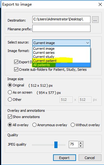 MicroDicom viewer(Dicom格式看圖軟件)