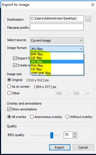 MicroDicom viewer(Dicom格式看圖軟件)